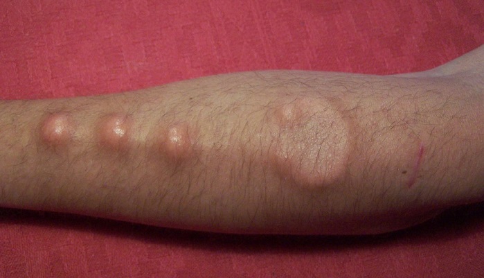 implant jpg